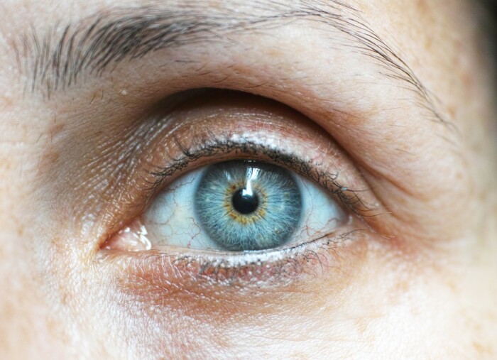 123Lens draagt bij aa bewustwording rondom de symptomen van cataract