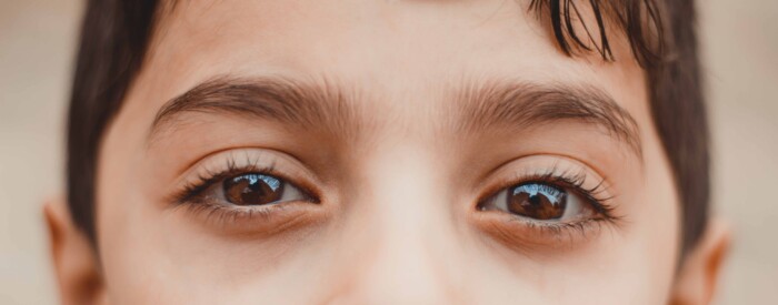 Wat veroorzaakt verwijde pupillen?